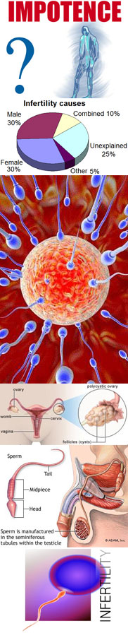 Infertility