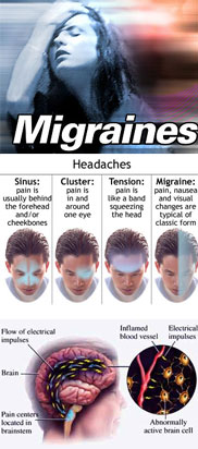 Migraine