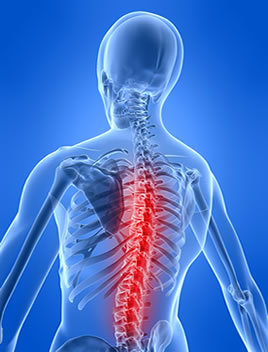 Arthritis