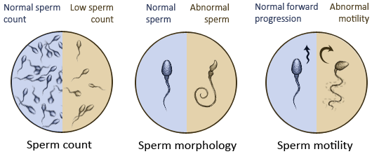 sperm quality